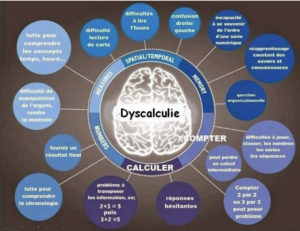 Symptomes - Discalculie