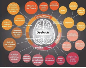 Les symptômesde la Dyslexie