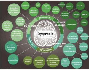 Les symptômes de la dysprasie